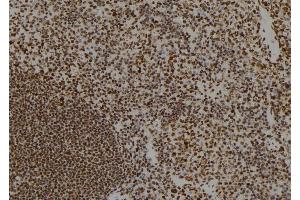ABIN6279693 at 1/100 staining Mouse spleen tissue by IHC-P.