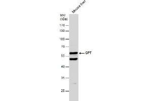 WB Image Mouse tissue extract (50 μg) was separated by 10% SDS-PAGE, and the membrane was blotted with GPT antibody [N1N3] , diluted at 1:500. (ALT anticorps  (N-Term))