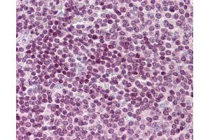 Immunohistochemistry (IHC) image for anti-Cell Division Cycle 20 Homolog (S. Cerevisiae) (CDC20) (N-Term) antibody (ABIN2774602)