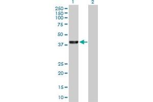Western Blot analysis of PARK2 expression in transfected 293T cell line by PARK2 MaxPab polyclonal antibody. (Parkin anticorps  (AA 1-387))