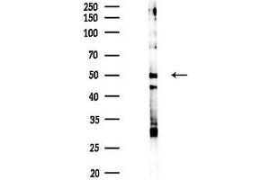 anti-SHC (Src Homology 2 Domain Containing) Transforming Protein 1 (SHC1) (pTyr427) antibody