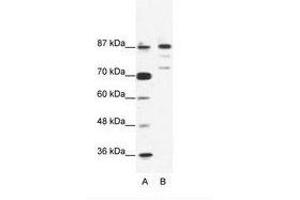 Image no. 1 for anti-BTB and CNC Homology 1, Basic Leucine Zipper Transcription Factor 1 (BACH1) (C-Term) antibody (ABIN203248) (BACH1 anticorps  (C-Term))