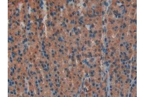 DAB staining on IHC-P; Samples: Rat Stomach Tissue