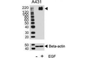 Western blot analysis of lysate from A431 cell line, untreated or treated with EGF (100ng/ml), using phospho-ErbB2 antibody. (ErbB2/Her2 anticorps  (pTyr1140))