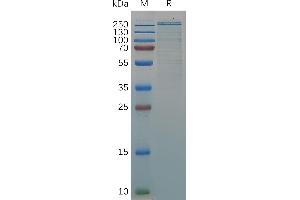 Human VWF (23-2813) Protein, His Tag on SDS-PAGE under reducing condition.