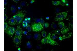 Image no. 1 for anti-Hydroxysteroid (17-Beta) Dehydrogenase 10 (HSD17B10) antibody (ABIN1498724)