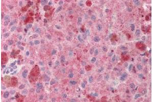 anti-POU Class 5 Homeobox 1 (POU5F1) (AA 114-163) antibody