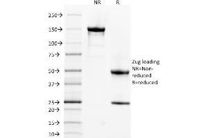 SDS-PAGE Analysis Purified Spectrin alpha 1 Mouse Monoclonal Antibody (SPTA1/1832).