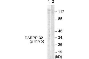 Western Blotting (WB) image for anti-Protein Phosphatase 1, Regulatory (Inhibitor) Subunit 1B (PPP1R1B) (pThr75) antibody (ABIN1847208) (DARPP32 anticorps  (pThr75))