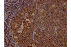 IHC image of ABIN7127806 diluted at 1:100 and staining in paraffin-embedded human tonsil tissue performed on a Leica BondTM system.