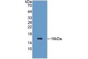 Detection of Recombinant GHRH, Mouse using Polyclonal Antibody to Growth Hormone Releasing Hormone (GHRH) (GHRH anticorps  (AA 20-97))