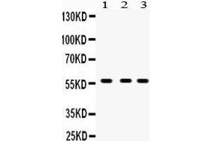 Western Blotting (WB) image for anti-Cytochrome P450, Family 27, Subfamily B, Polypeptide 1 (CYP27B1) (AA 475-508), (C-Term) antibody (ABIN3042787) (CYP27B1 anticorps  (C-Term))
