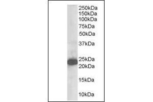 Western analysis (1 µg/ml) of Human Brain lysate (RIPA buffer, 35 µg total protein per lane). (STMN2 anticorps  (N-Term))