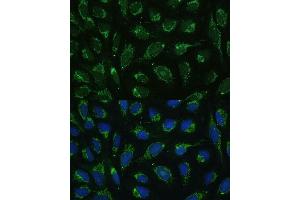 Immunofluorescence analysis of U-2 OS cells using C1 Polyclonal Antibody (ABIN7265723) at dilution of 1:100 (40x lens).