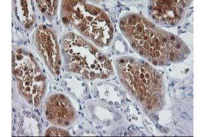 Immunohistochemical staining of paraffin-embedded Human Kidney tissue using anti-SIRT5 mouse monoclonal antibody. (SIRT5 anticorps)