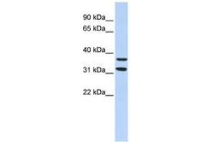 Image no. 1 for anti-Zinc Finger Protein 254 (ZNF254) (AA 151-200) antibody (ABIN6744476) (ZNF254 anticorps  (AA 151-200))