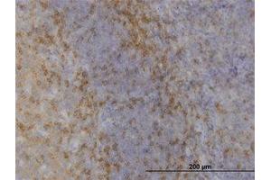 Image no. 1 for anti-Mitogen-Activated Protein Kinase 12 (MAPK12) (AA 251-368) antibody (ABIN598915) (MAPK12 anticorps  (AA 251-368))