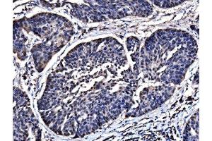 IHC analysis of HSPA6 using anti-HSPA6 antibody (ABIN7601944). (HSPA6 anticorps  (AA 516-643))