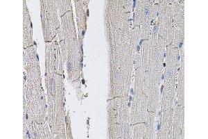 Immunohistochemistry of paraffin-embedded Mouse heart using GLUT3 Polyclonal Antibody (SLC2A3 anticorps)