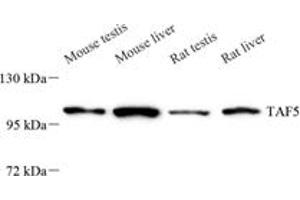 Western blot analysis of TAF5 (ABIN7075828),at dilution of 1: 800 (TAF5 anticorps)