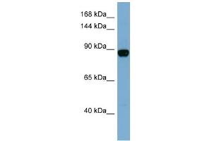 WB Suggested Anti-CASD1 Antibody Titration:  0.