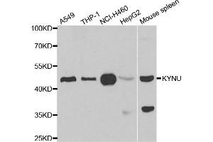 Western blot analysis of extracts of various cell lines, using KYNU antibody. (KYNU anticorps)