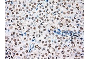 Image no. 1 for anti-TYRO3 Protein Tyrosine Kinase (TYRO3) antibody (ABIN1501605)