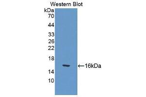 Western blot analysis of the recombinant protein. (CUBN anticorps  (AA 98-207))