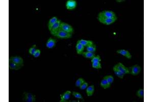 Immunofluorescence staining of HepG2 cells with ABIN7165300 at 1:133, counter-stained with DAPI. (DOK7 anticorps  (AA 416-504))