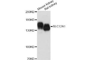 Western blot analysis of extracts of various cell lines, using SLC12A1 antibody. (SLC12A1 anticorps)