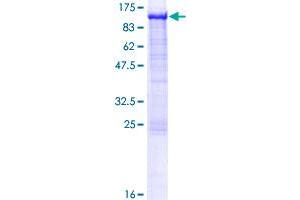 Image no. 1 for P450 (Cytochrome) Oxidoreductase (POR) (AA 1-680) protein (GST tag) (ABIN1315762)