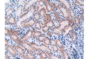 DAB staining on IHC-P; Samples: Mouse Kidney Tissue (CTLA4 anticorps  (AA 45-185))