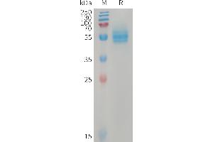 Human CD14(20-352) Protein, His Tag on SDS-PAGE under reducing condition.