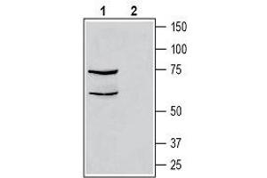 Western blot analysis of human THP-1 monocytic leukemia cell line lysate: - 1. (CALCRL anticorps  (C-Term, Intracellular))