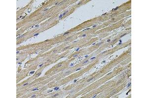 Immunohistochemistry of paraffin-embedded Rat heart using EIF4A2 Polyclonal Antibody at dilution of 1:100 (40x lens).