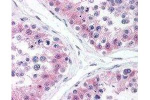 Immunohistochemistry (IHC) image for anti-Mitogen-Activated Protein Kinase 1 (MAPK1) antibody (ABIN2666104)