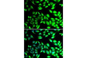 Immunofluorescence analysis of U20S cell using PDIA6 antibody. (PDIA6 anticorps)