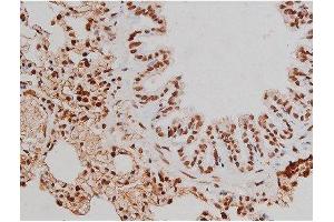 ABIN6267365 at 1/200 staining Rat lung tissue sections by IHC-P.
