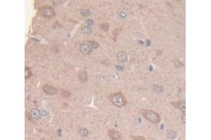 IHC-P analysis of Rat Tissue, with DAB staining. (KIF5A anticorps  (AA 823-1027))