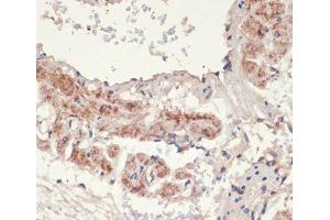 Immunohistochemistry of paraffin-embedded Rat lung using ADRA1A Polyclonal Antibody at dilution of 1:100 (40x lens). (alpha 1 Adrenergic Receptor anticorps)