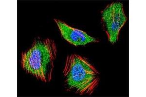 Fluorescent confocal image of HeLa cell stained with SMAD4 antibody at 1:25.