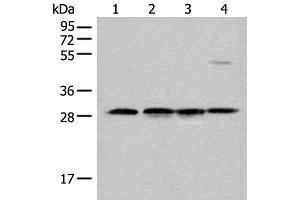 Western blot analysis of Human urinary bladder tissue Mouse heart tissue Mouse kidney tissue and RAW264. (CA7 anticorps)