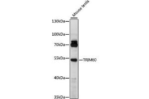 Western blot analysis of extracts of mouse testis, using TRIM60 antibody (ABIN7270995) at 1000 dilution. (TRIM60 anticorps  (AA 1-300))