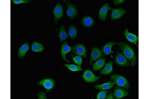 Immunofluorescent analysis of A549 cells using ABIN7147114 at dilution of 1:100 and Alexa Fluor 488-congugated AffiniPure Goat Anti-Rabbit IgG(H+L) (CD151 anticorps  (AA 125-199))