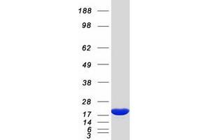 Non-Metastatic Cells 1, Protein (NM23A) Expressed in (NME1) (Transcript Variant 1) protein (Myc-DYKDDDDK Tag)