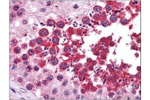 Human Testis: Formalin-Fixed, Paraffin-Embedded (FFPE)
