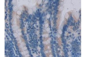 Detection of CENTa2 in Rat Small intestine Tissue using Polyclonal Antibody to Centaurin Alpha 2 (CENTa2)