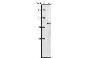 Western Blot showing IGF1R antibody used against truncated IGF1R recombinant protein. (IGF1R anticorps)