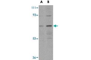 Western blot analysis of NOTUM in human kidney tissue lysate with NOTUM polyclonal antibody  at (A) 0. (NOTUM anticorps  (N-Term))