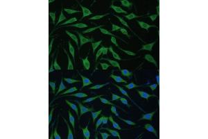 anti-Family with Sequence Similarity 127, Member B (FAM127B) (AA 1-113) antibody